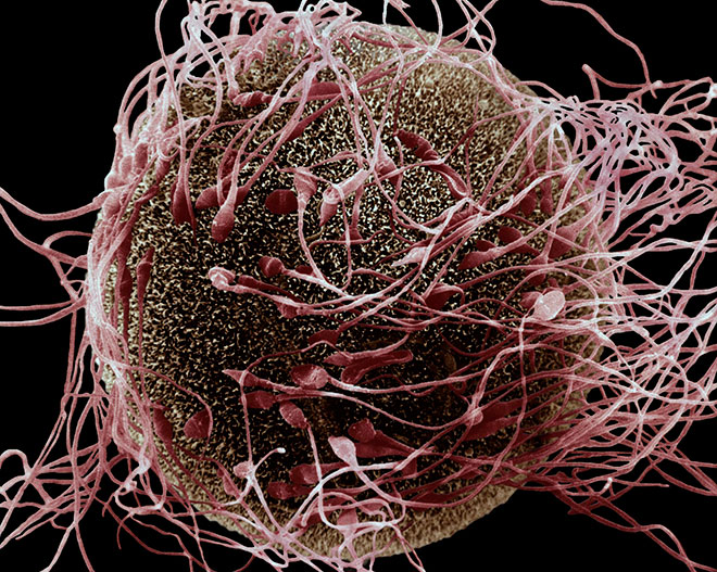 сперматозоиды оплодотворяют яйцеклетку под микроскопом