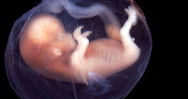 фотография человеческого зародыша на ранней стадии развития