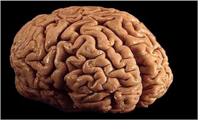 Почему возникает отек и набухание головного мозга