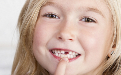 молочные зубы у ребенка выпадают