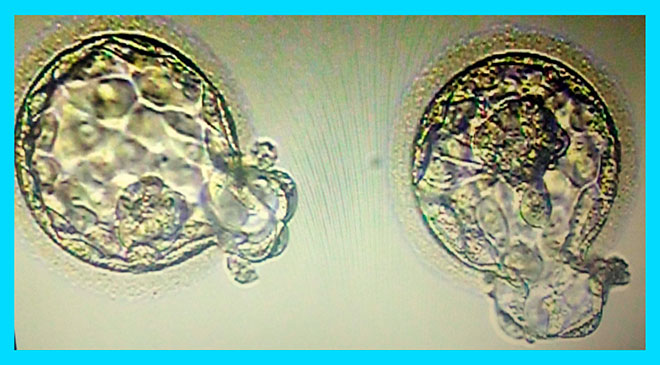 процесс хетчинга эмбриона человека