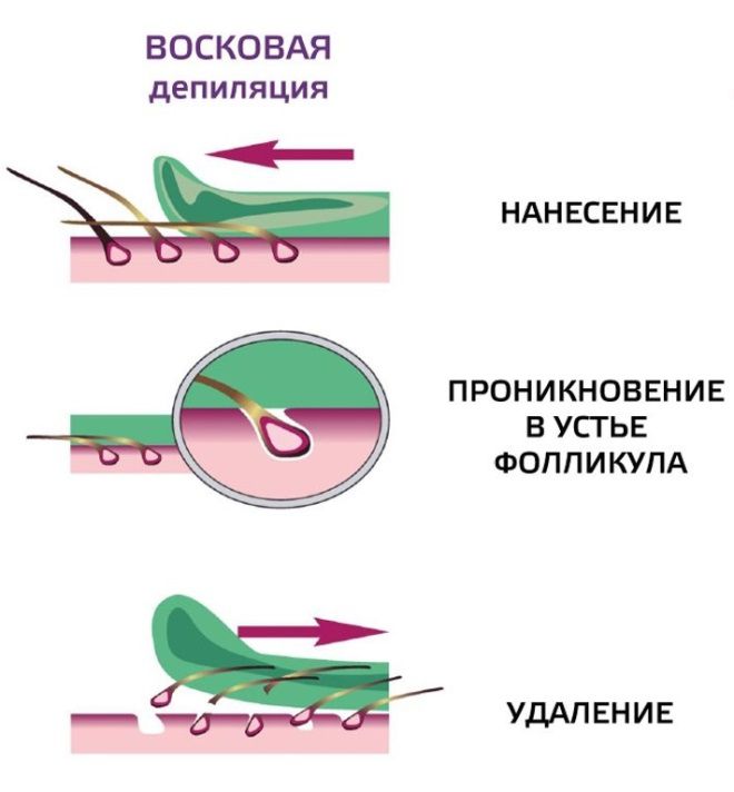 Схема ваксинга