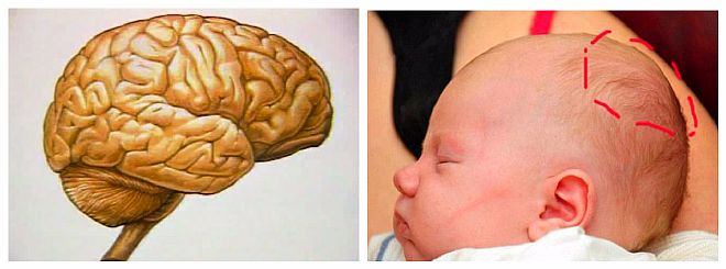 Мозг больного ребенка