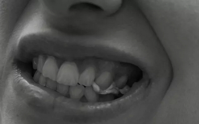 зубы реагируют только на сладкое