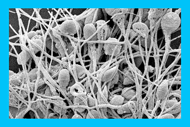фотография склеенных между собой сперматозоидов под микроскопом