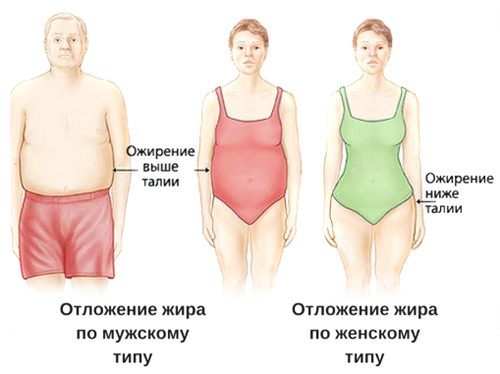 Ожирение по мужскому и женскому типу