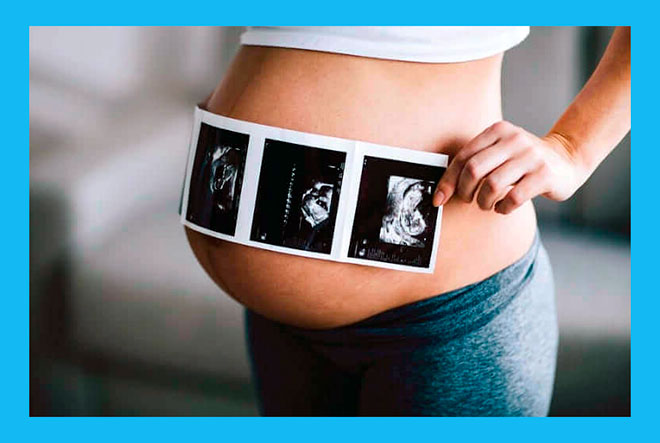 беременная девушка держит снимок узи на большом животе