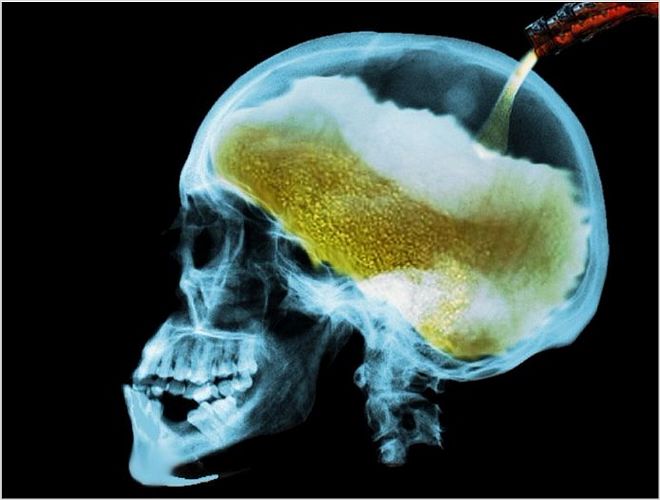 Мозг алкоголика и здорового человека фото