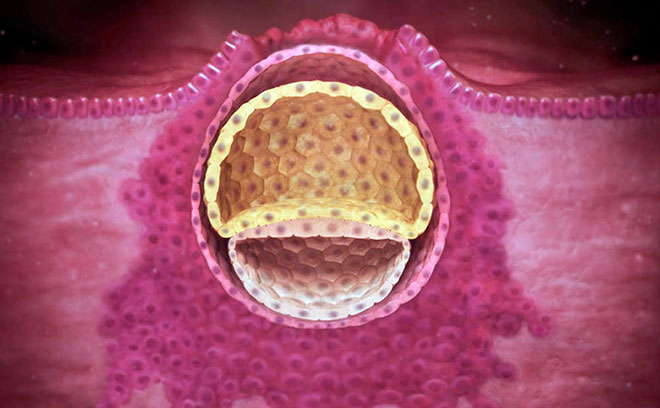 имплантация эмбриона в стеку матки