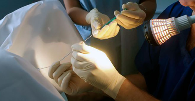 подсадка эмбриона в гинекологическом кресле при эко