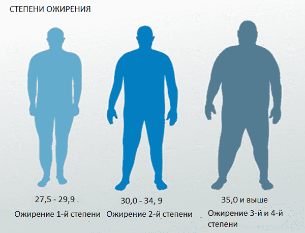 Сколько людей с ожирением. Алиментарное ожирение 1 степени у мужчин. Ожирение 3-4 степени у мужчин. Ожирение первой степени второй и третьей. Ожирение 3 степени.