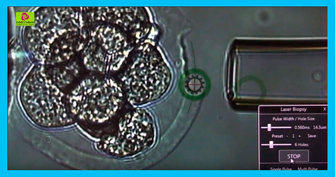 лазерный хетчинг под микроскопом