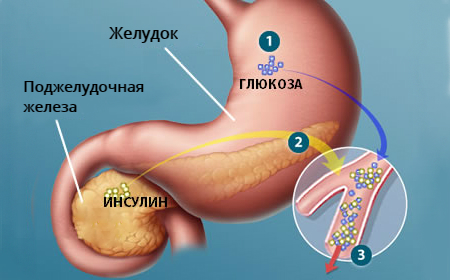 Процесс гиперфункции в поджелудочной железе