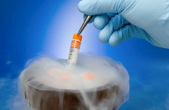 криоконсервация эмбрионов до лучшего момента для искусственного оплодотворения