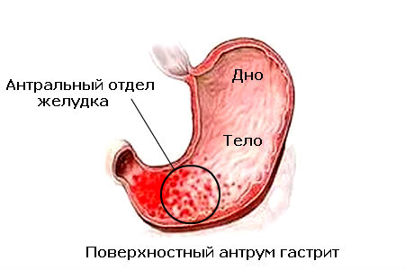Схема расположения антрального отдела желудка