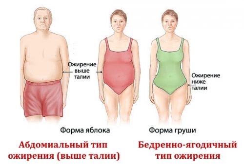 Абдомиальный тип ожирения выше талии