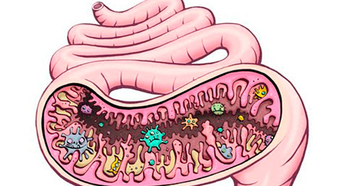 Дизбактериоз в кишечнике