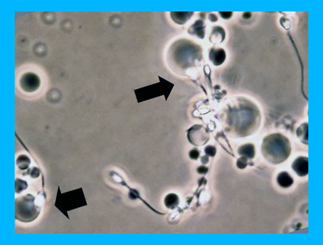 асат и сперматозоиды под микроскопом
